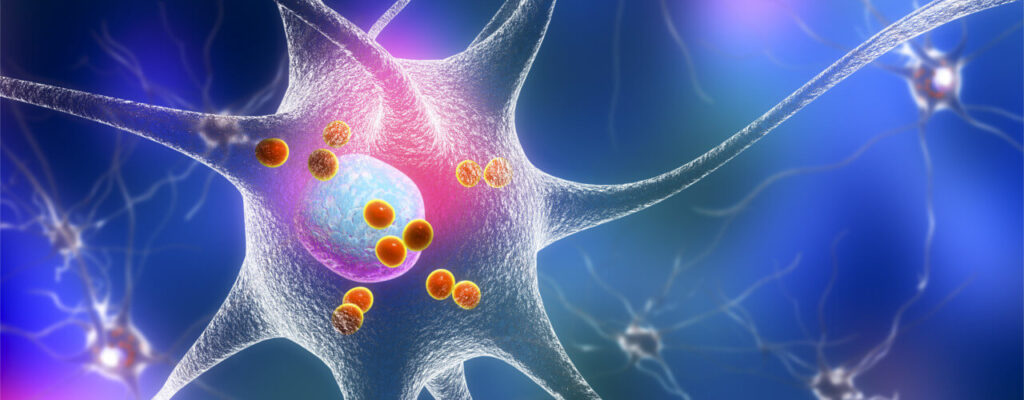 Neurological Disorders