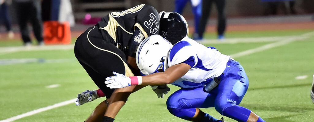 Post Concussion Syndrome