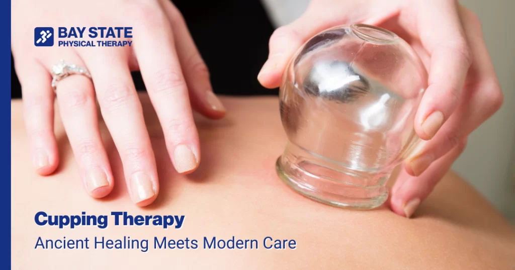 Cupping Therapy: Ancient Healing Meets Modern Care