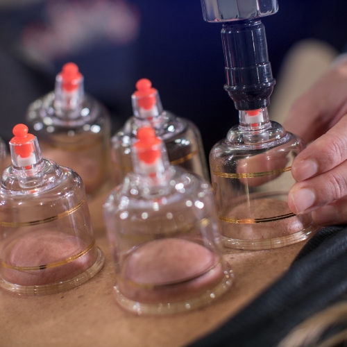 Baystate-Physical-Therapy-Massachusetts-Rhode-Island-Maine-New-Hampshire-New-York-cupping